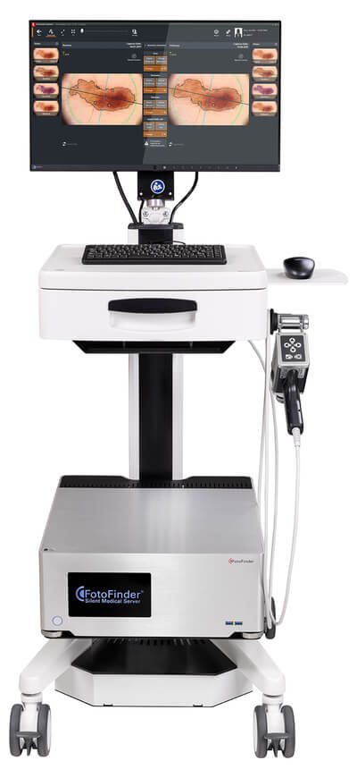 Fotofinder System, Dr. Christian Fellenz, Hautarzt in Wien