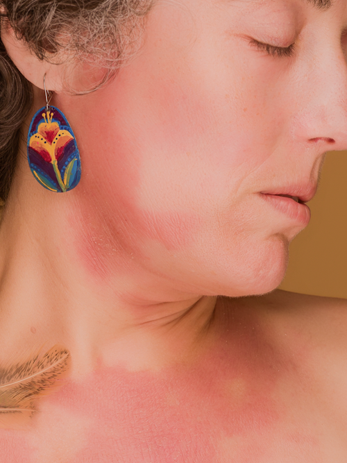LED-Lichttherapie, Dr. Christian Fellenz, Hautarzt in Wien